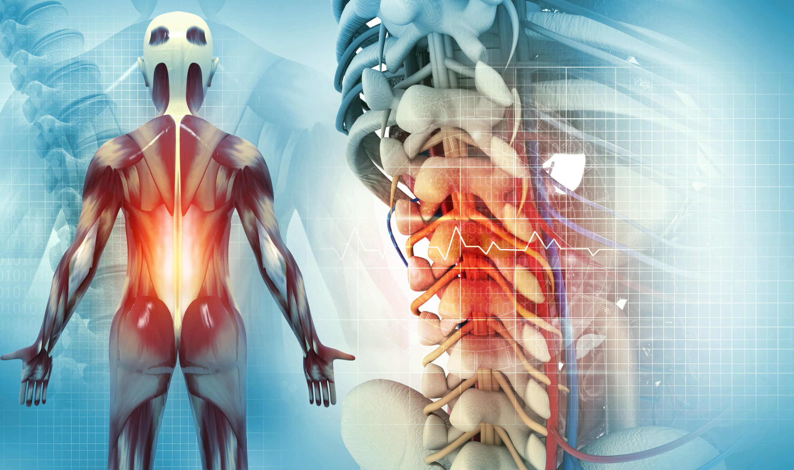 Spine cancer or spinal disease, 3d illustration