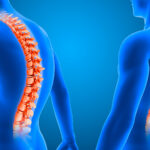 Artrodese-Vertebral--Avaliando-os-Benefícios-e-Riscos-da-Fusão-da-Coluna
